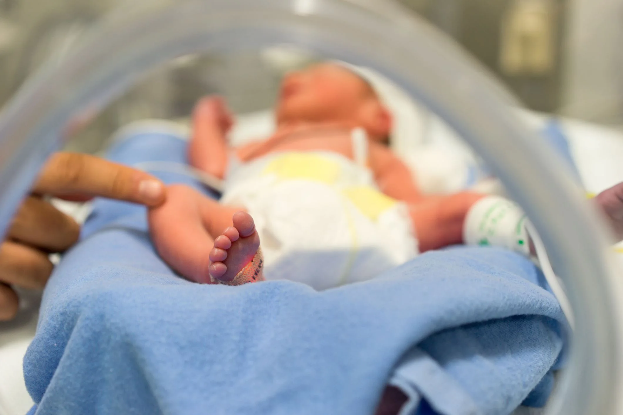 How Negligent Doctors Can Cause Cerebral Palsy